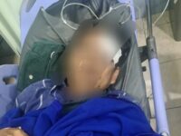 Seorang guru korban penganiayaan di Teluk Pandan, Kabupaten Kutai Timur (dok: ist)